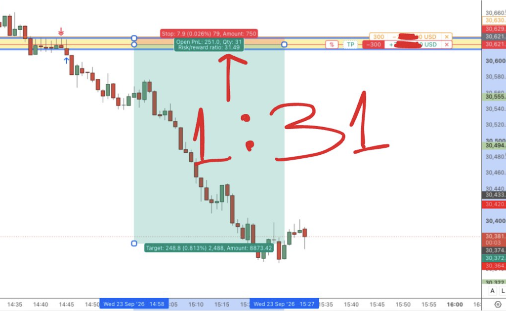 31R asymmetric trade